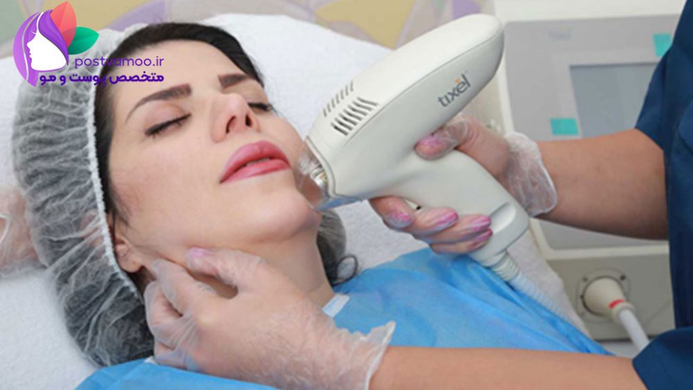 دستگاه تیکسل جدید ترین روش برای از بین بردن لکه پوستی