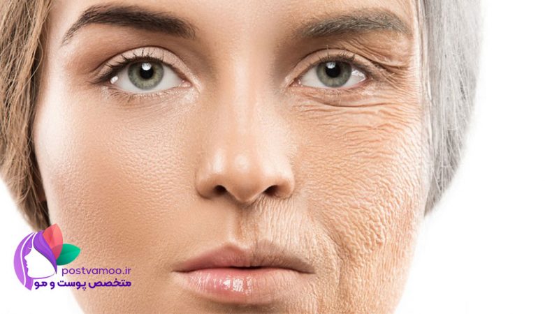 پیری زودرس پوست چیست