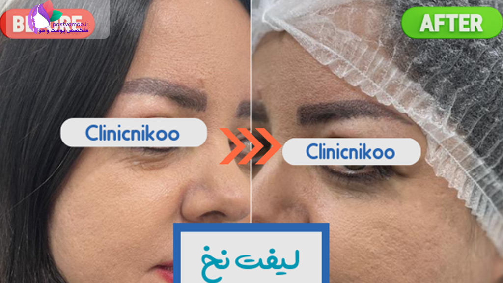 کلینیک تخصصی پوستی و مو و لیزر نیکو در شیراز