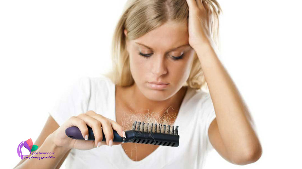 ماینوکسیدیل راه موثر در درمان ریزش مو