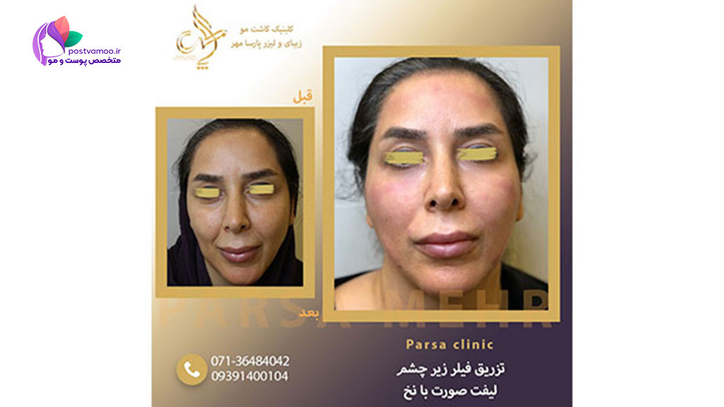 خدمات کلینیک تخصصی زیبایی پارسا مهر