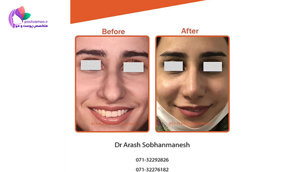 خدمات دکتر آرش سبحان منش جراح زیبایی