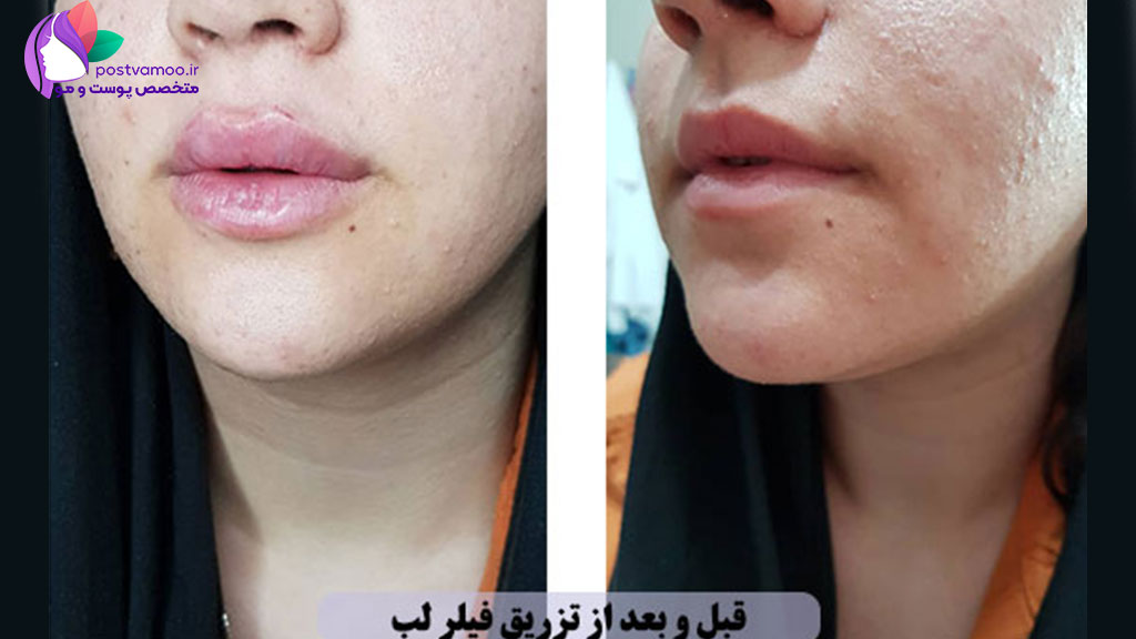 خدمات کلینیک پوست، مو و زیبایی دکتر قادری در شیراز