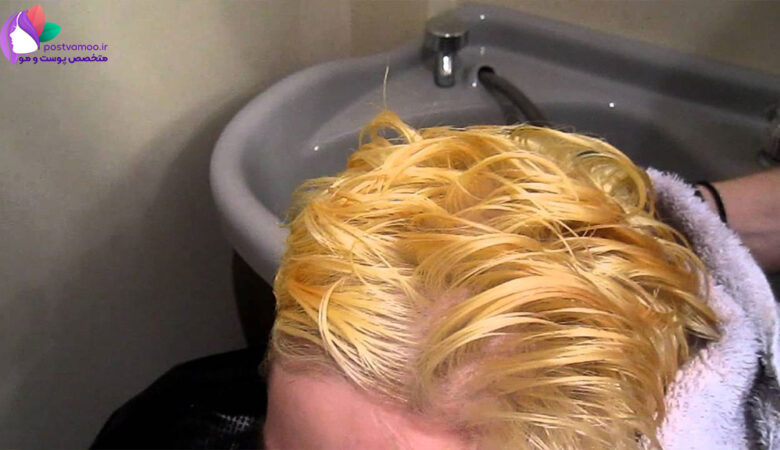 علت زرد شدن مو بعد از کراتینه