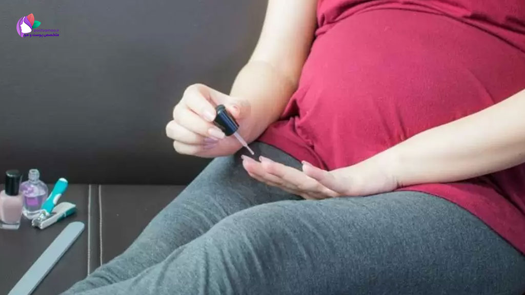 تحقیقات درباره کاشت ناخن در دروان بارداری