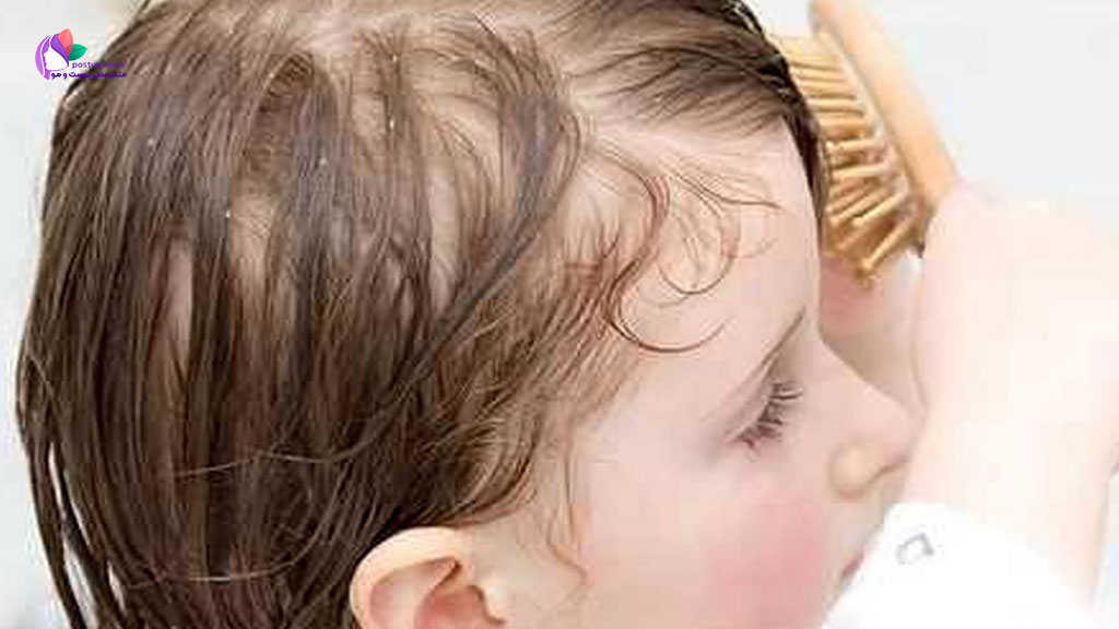 دلایل پزشکی ریزش مو در کودکان
