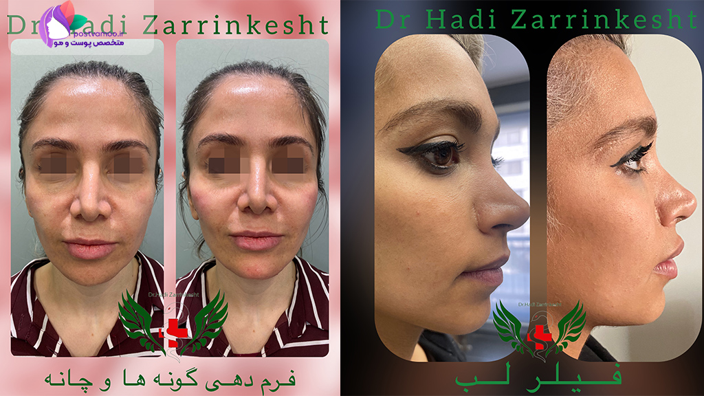 مرکز پوست، مو، زیبایی و لیزر دکتر محمدهادی زرین کشت