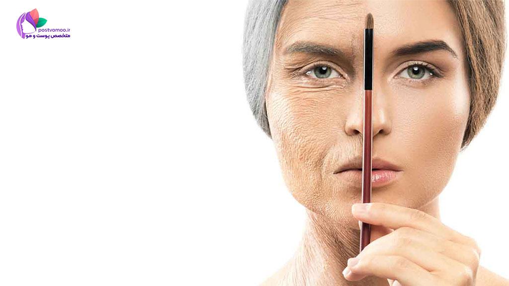 پیری زودرس پوست چیست؟