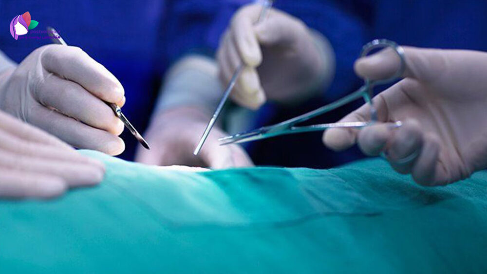 بهترین جراح برداشتن رحم در شیراز